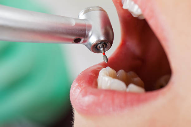 Best Emergency Gum Treatment in Indianola, MS
